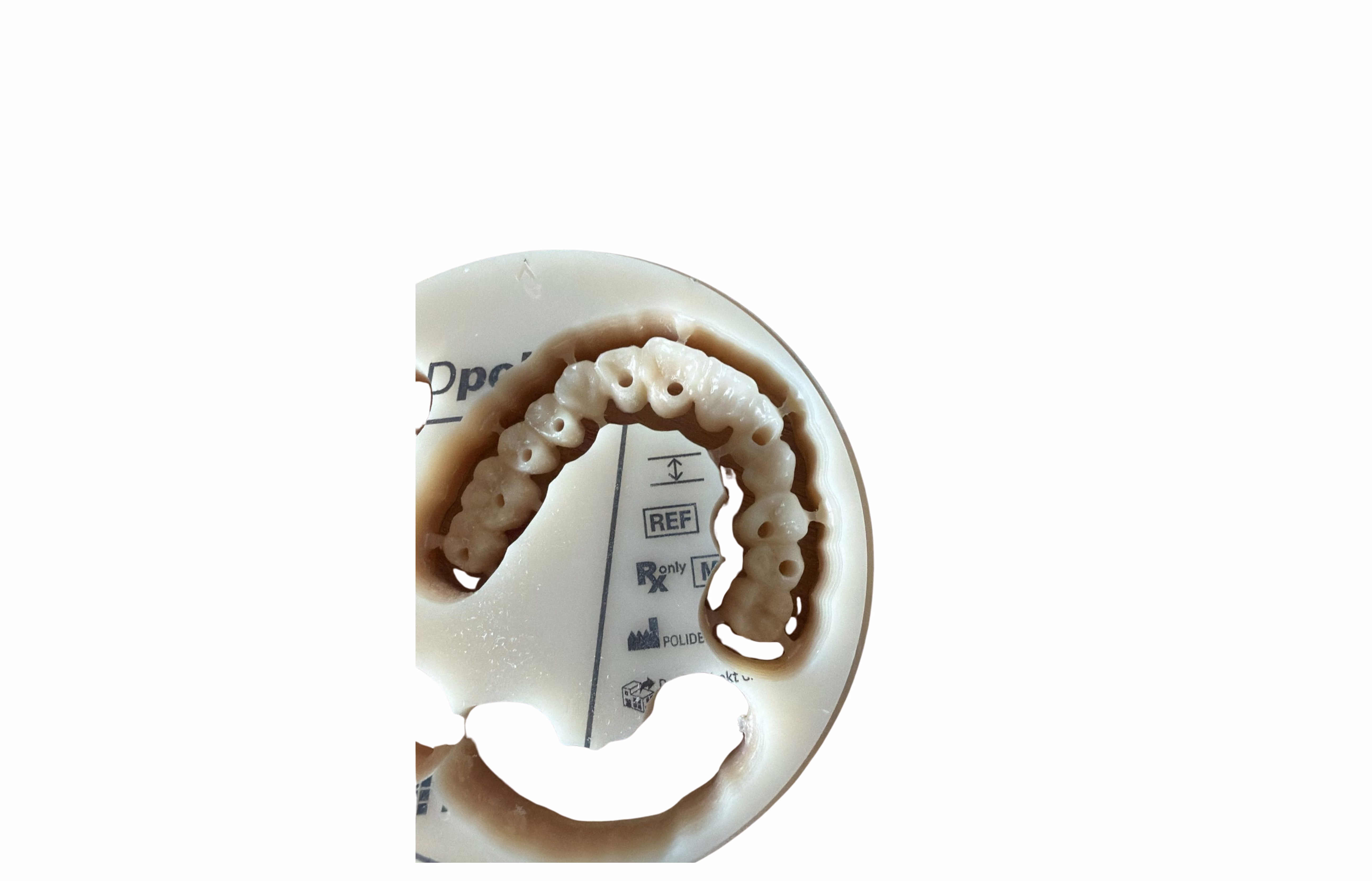 Usinage en PMMA multi-couche suite implantation : prothèse provisoire usinée au laboratoire, vue 2.