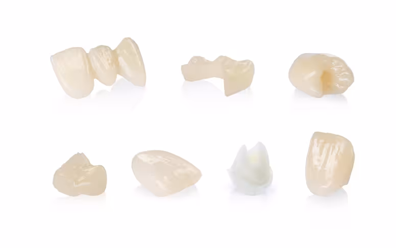 Broad spectrum of applications crown inlay onlay veneers bridges implant
