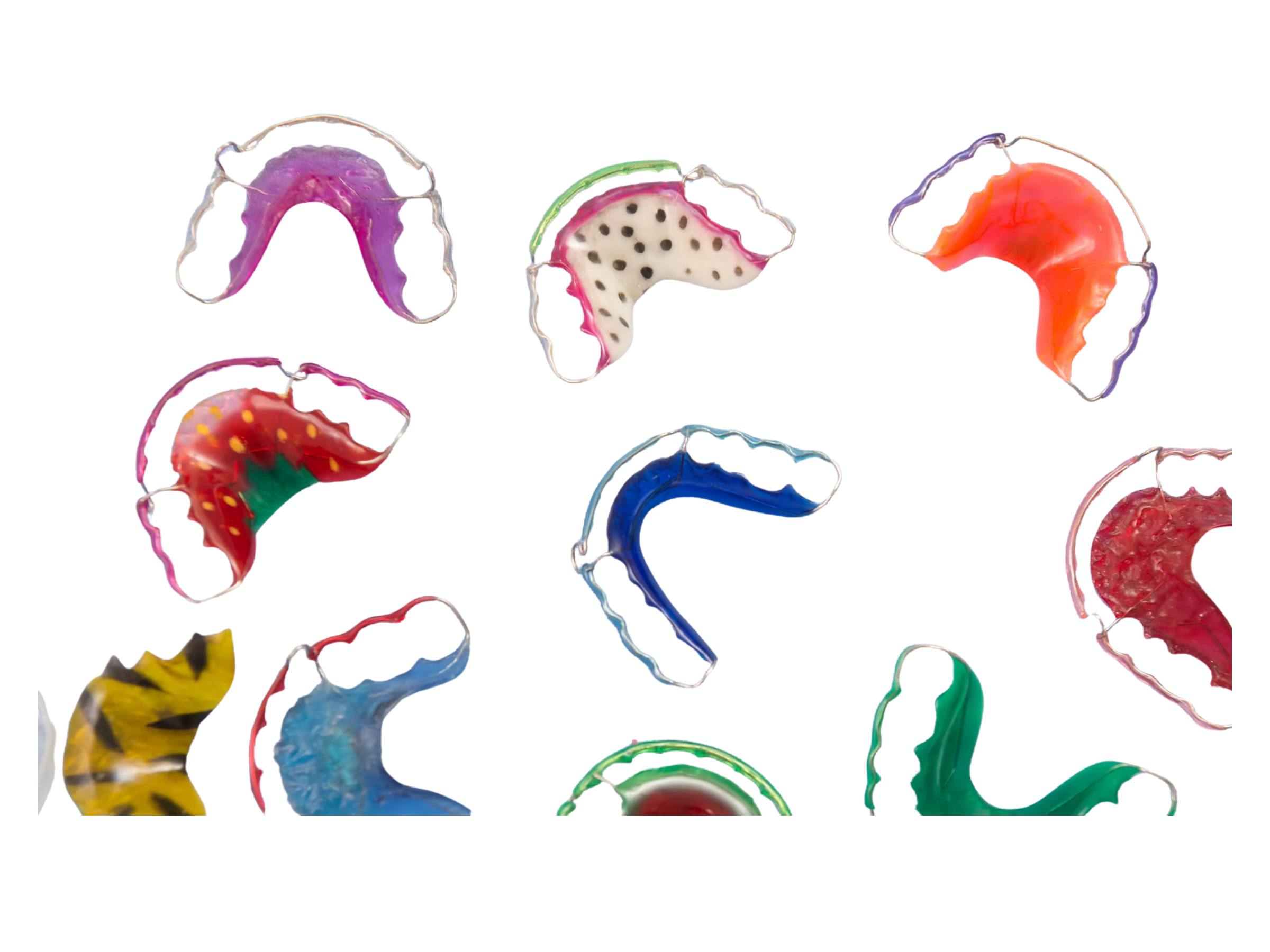 Orthodontie et gouttières sur-mesure